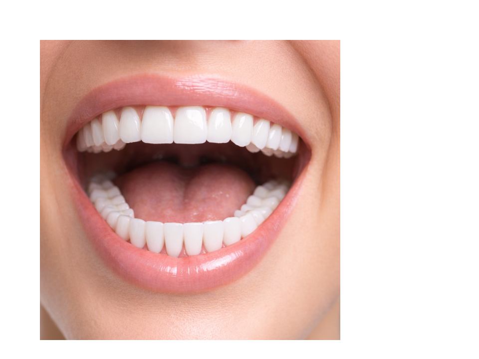 Full Mouth Rehabilitation